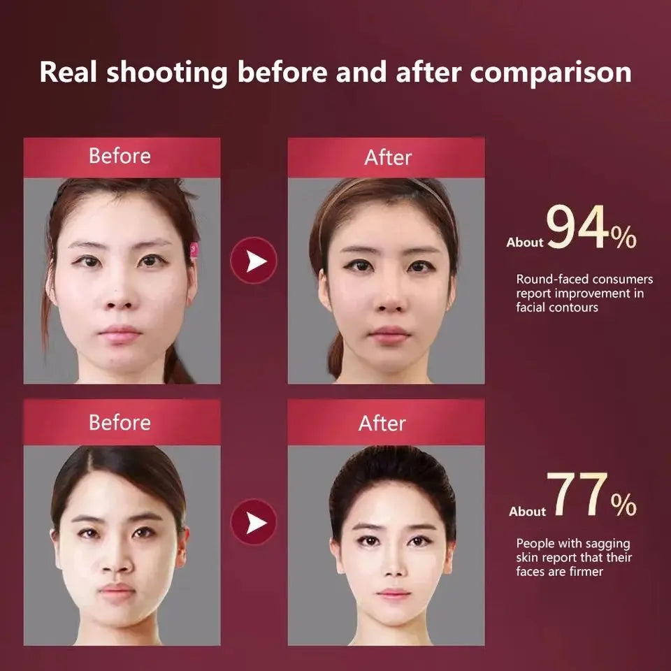 LED Facial Lifting Electric Device, Face Slimming Massager V-Line Chin Lift Beauty Device Red Blue Light Therapy Facial Sculpting Machine Anti-Wrinkle Skin Tightening Double Chin Reducer USB Rechargeable