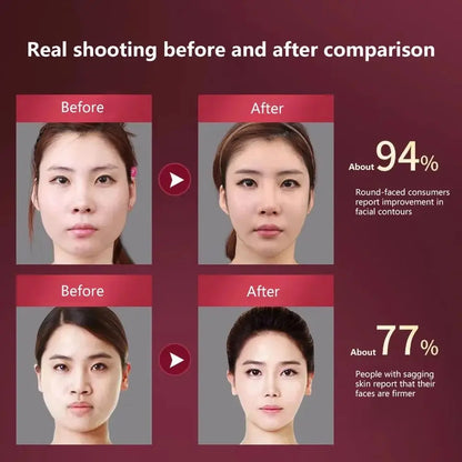 LED Facial Lifting Electric Device, Face Slimming Massager V-Line Chin Lift Beauty Device Red Blue Light Therapy Facial Sculpting Machine Anti-Wrinkle Skin Tightening Double Chin Reducer USB Rechargeable