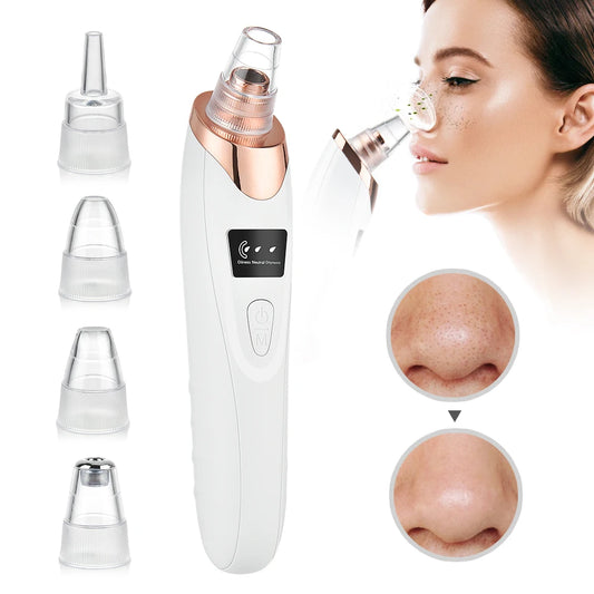 BLACKHEAD VACUUM PRO – Deep Pore Cleaner with 5 Suction Heads & Adjustable Suction Levels