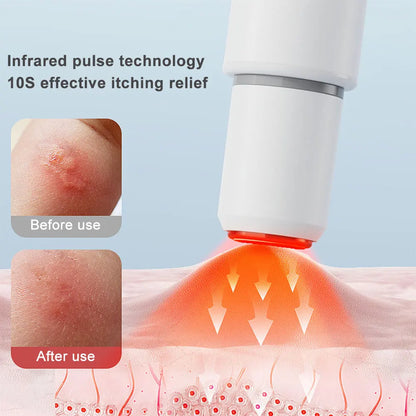 Mosquito Bite Relief Pen PRO – Chemical-Free Electronic Itch Relief for Kids & Adults | USB-C Rechargeable